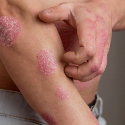 VIP Rheumatology