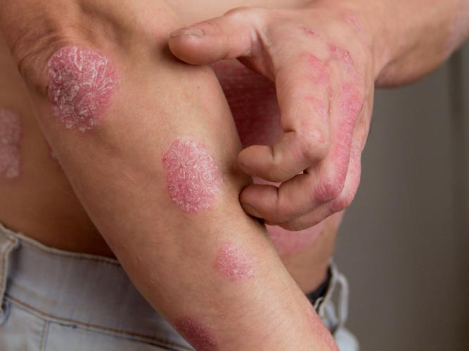 VIP Rheumatology
