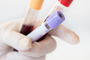A Complete Guide to the NIPT Test Procedure: Accuracy, Process, and Benefits